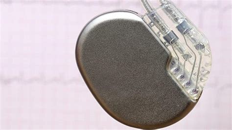 Pacemaker komplikationer